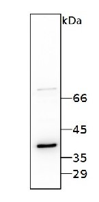 RBP40 | 38 kDa RNA-binding protein in the group Antibodies Plant/Algal  / Chlamydomonas reinhardtii at Agrisera AB (Antibodies for research) (AS14 2820)